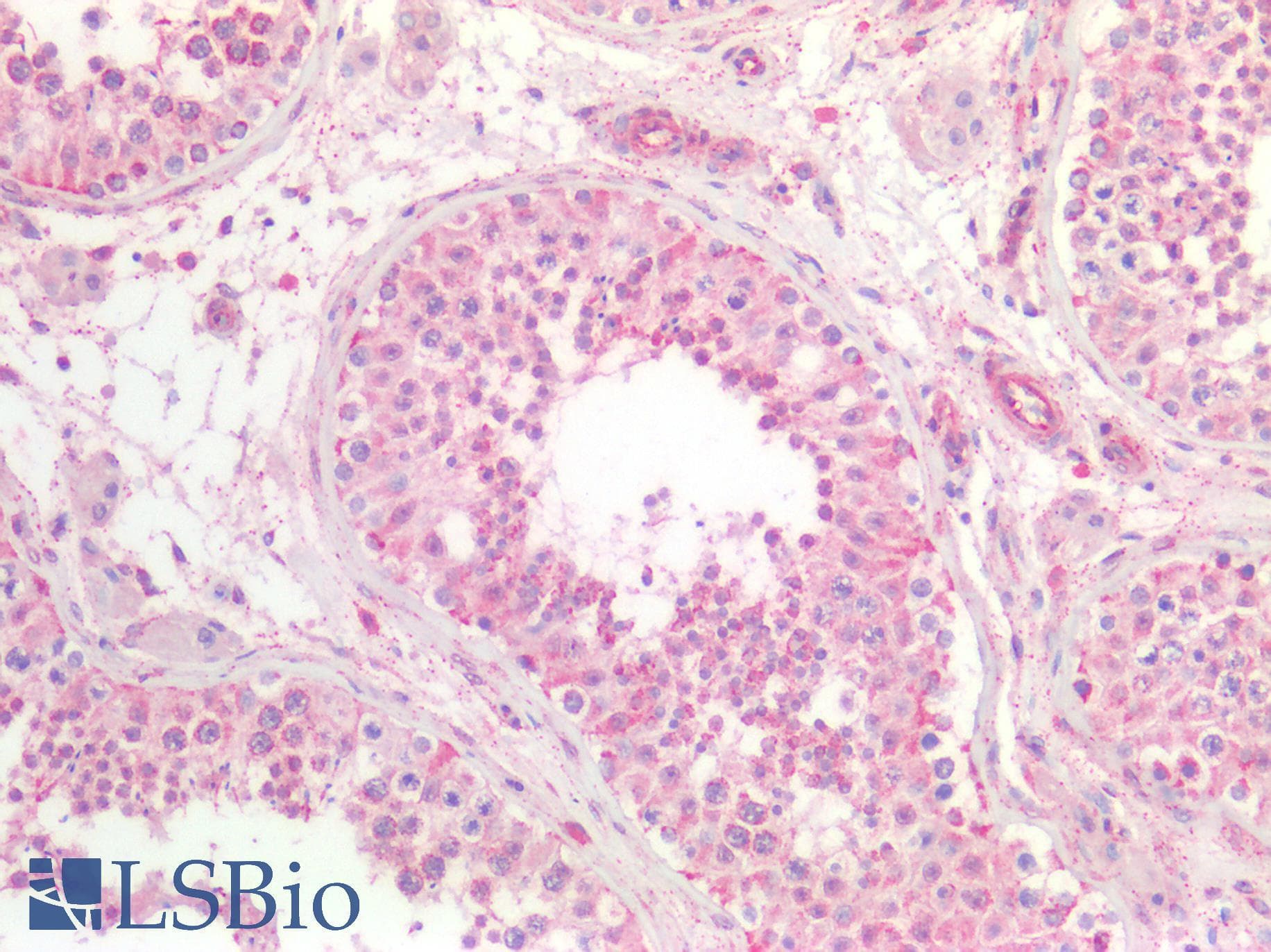 IHC-plus™ Polyclonal Rabbit anti-Human IL25 / IL17E Antibody (IHC)