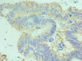 Polyclonal Rabbit anti-Human CDH17 / Cadherin 17 Antibody (aa573-832, IHC)