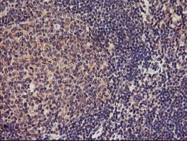 TMEFF2 Antibody (clone OTI1F9)