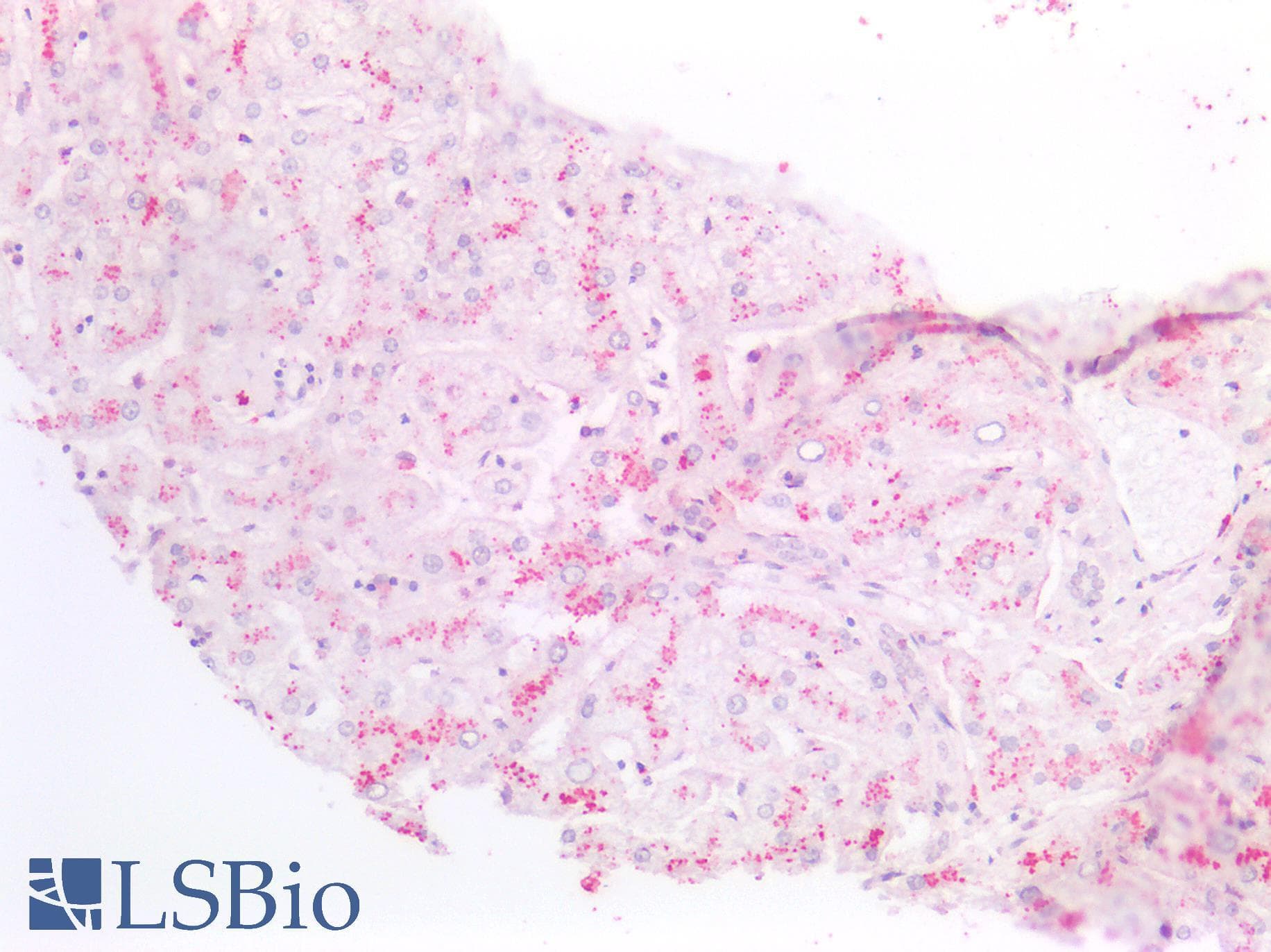 PathPlus™ Monoclonal Mouse anti-Human S100A8 / MRP8 Antibody (clone CF-145, IHC, IF, WB)