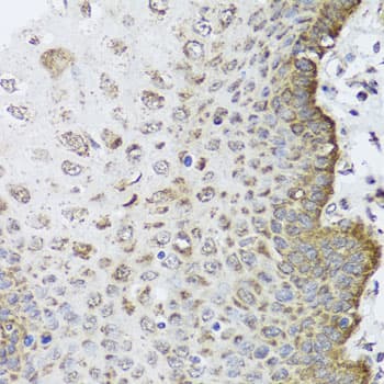 Polyclonal Rabbit anti-Human PHF9 / FANCL Antibody (IHC, WB)