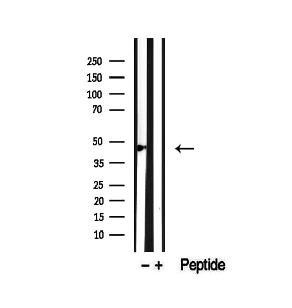 Polyclonal Rabbit anti-Human SMYD3 Antibody (IHC, IF, WB)