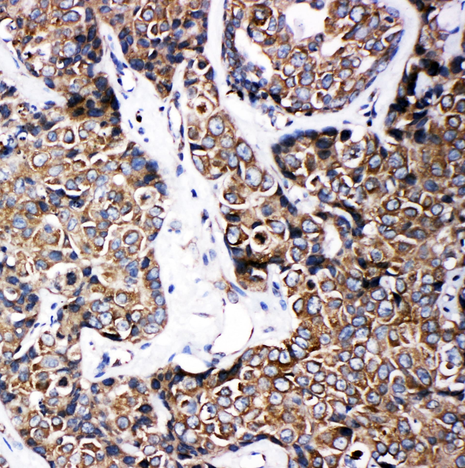 Polyclonal Rabbit anti-Human ABCB6 Antibody (aa818-842, IHC, WB)