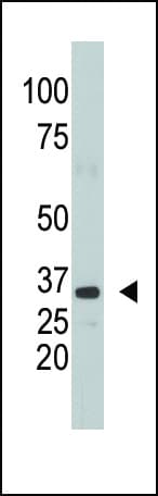 SULT1A1 / Sulfotransferase 1A1 Antibody (aa128-160)