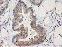 PLEKHA3 Antibody (clone OTI6E4)