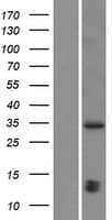 SHOX2 Protein (Over-Expression Lysate Myc-DDK (Flag))
