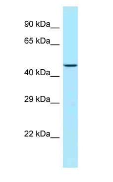 Polyclonal Rabbit anti-Human LIMS1 / PINCH Antibody (C-Terminus, WB)