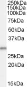 IHC-plus™ Polyclonal Goat anti-Human TPD52L2 / HD54 Antibody (aa195-205, IHC, WB)