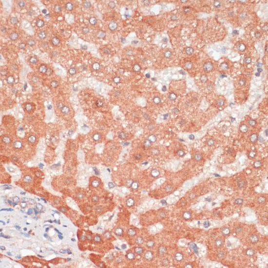 Polyclonal Rabbit anti-Human APG5 / ATG5 Antibody (IHC)