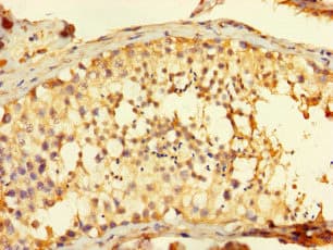 Polyclonal Rabbit anti-Human FAM71A Antibody