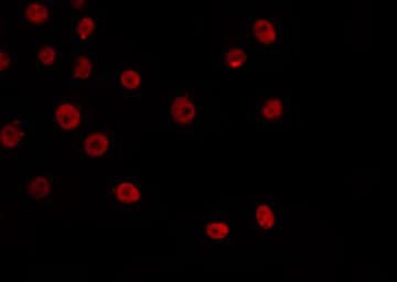 Polyclonal Rabbit anti-Human E2F6 Antibody (IHC, IF, WB)
