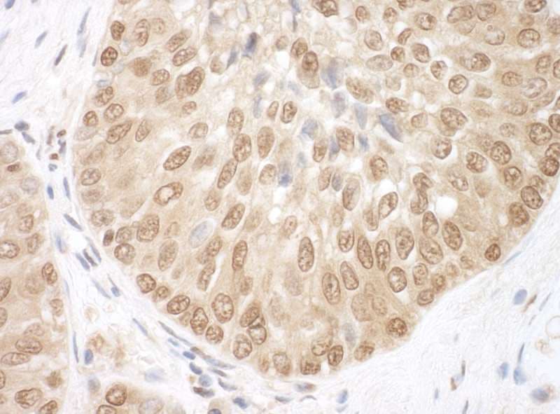 Polyclonal Rabbit anti-Human BRCC3 / BRCC36 Antibody (aa266-316, IHC, WB)