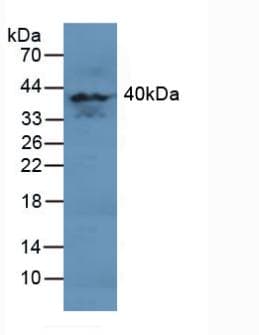 MAPK11 / SAPK2 / p38 Beta Antibody (aa38-277)