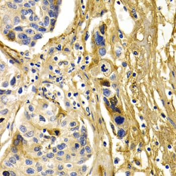 IHC-plus™ CFH / Complement Factor H Antibody