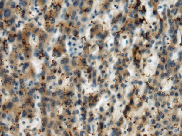 Polyclonal Rabbit anti-Human MICA Antibody (IHC)
