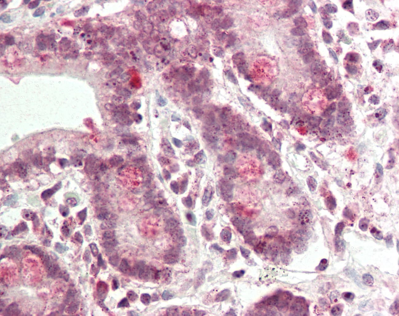 Polyclonal Rabbit anti-Human DDH / AKR1C1 Antibody (aa99-148, IHC, WB)