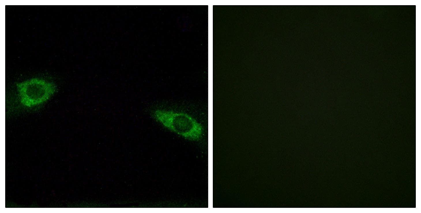 RPS4Y1 Antibody