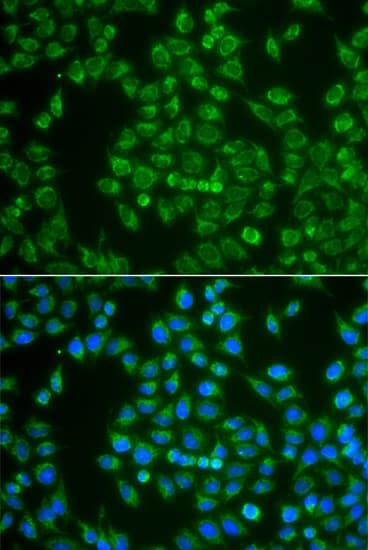 MAP4K3 / GLK Antibody (AP)