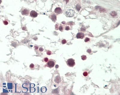 IHC-plus™ GFI1B Antibody (Internal)