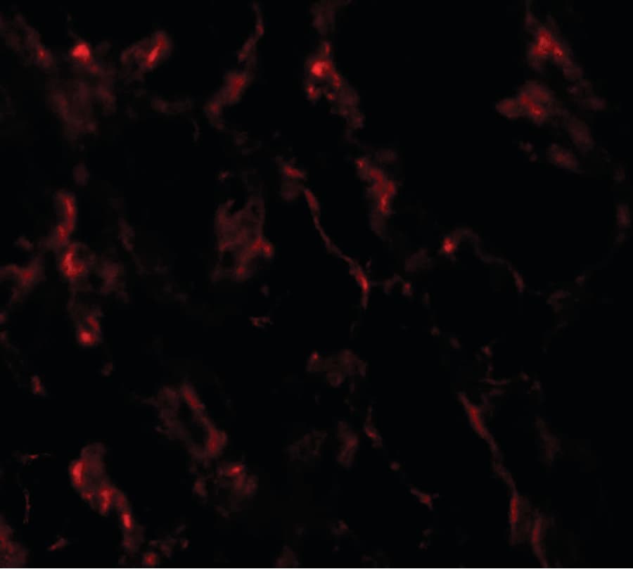 IHC-plus™ Polyclonal Rabbit anti-Human GHDC Antibody (IHC, IF, WB)