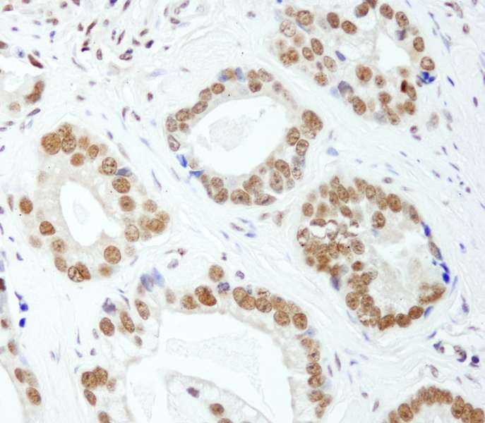 Polyclonal Rabbit anti-Human HNRNPUL1 Antibody (aa800-C-term, IHC, WB)