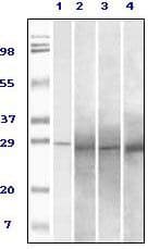 Monoclonal Mouse anti-Human RAB25 Antibody (clone 3F12F3, IHC, WB)