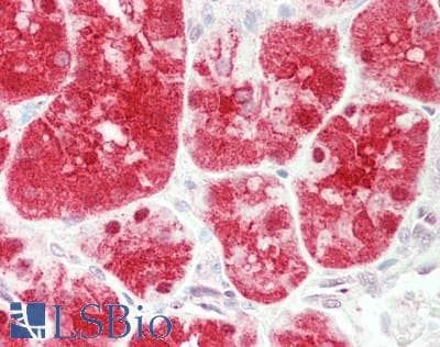 PEPD / PROLIDASE Antibody (aa359-408)