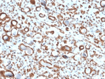 EMD / Emerin Antibody (clone EMD/2167)