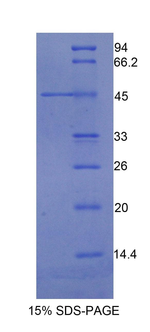 Human ITGAM / CD11b Protein (Recombinant His-GST)
