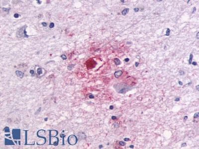 PathPlus™ Polyclonal Rabbit anti-Human GPR87 Antibody (C-Terminus, IHC)