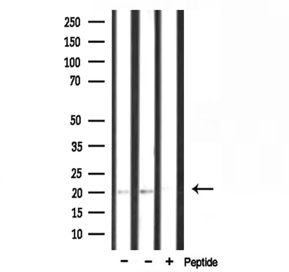 RPL15 / Ribosomal Protein L15 Antibody