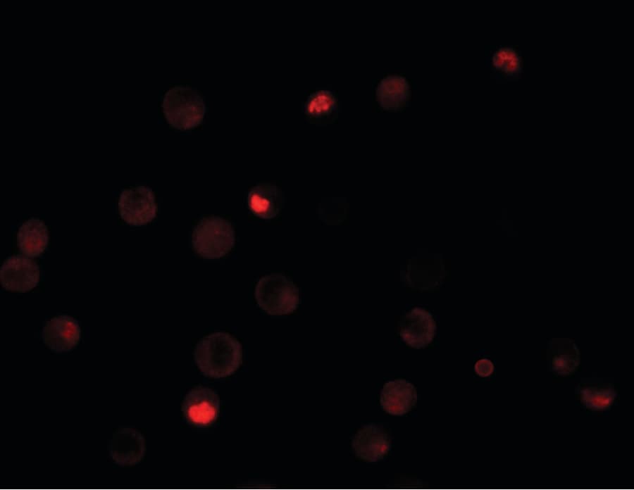 IHC-plus™ QIP1 / KPNA4 Antibody