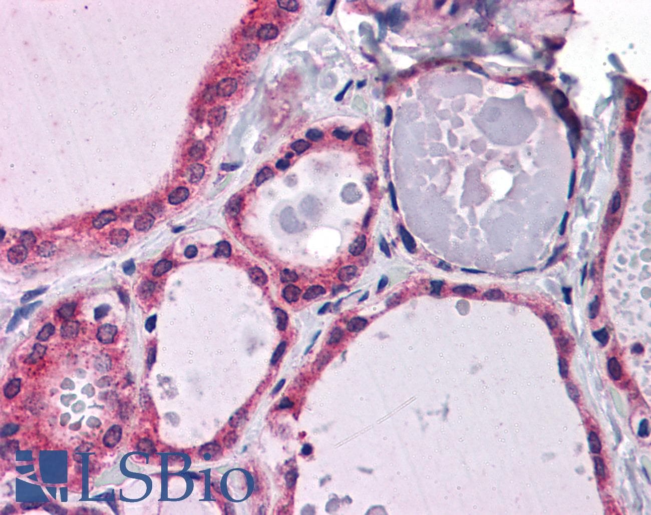 IHC-plus™ GALNT10 Antibody