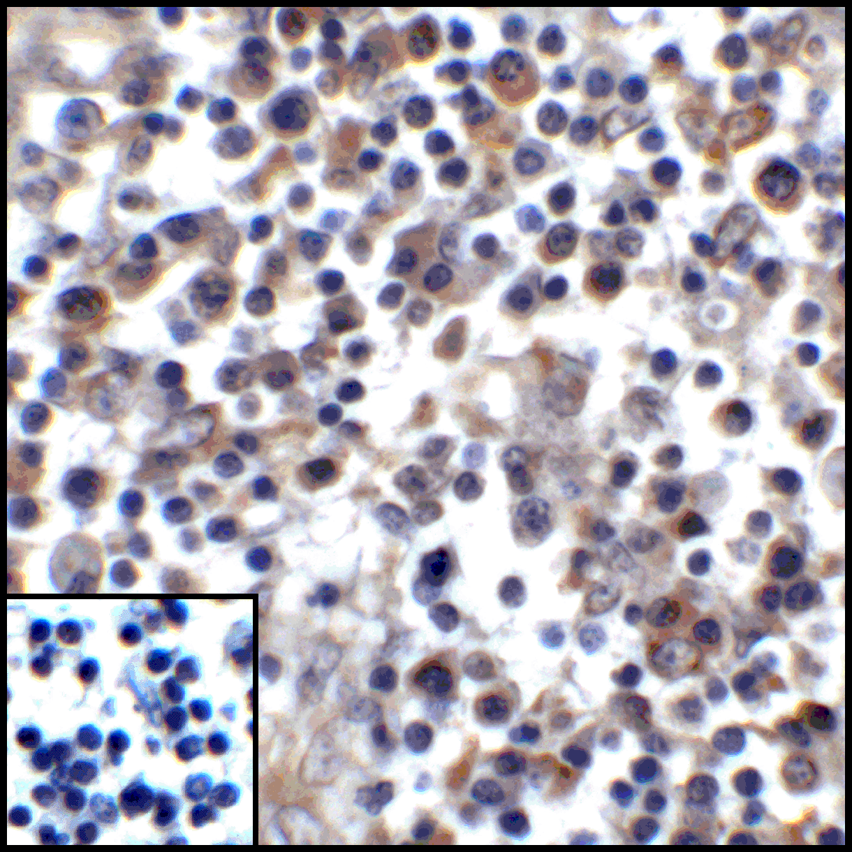 Monoclonal Mouse anti-Human CD274 / B7-H1 / PD-L1 Antibody (clone 4F2, IHC, IF, WB)