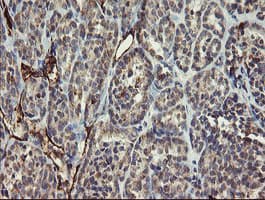PECAM-1 / CD31 Antibody (clone OTI2C3)