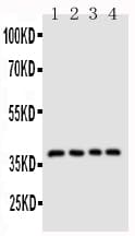 CD1D Antibody (aa76-92)