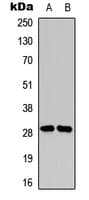 Polyclonal Rabbit anti-Human SNAI1 + SNAI2 Antibody (C-Terminus, IHC, IF, WB)
