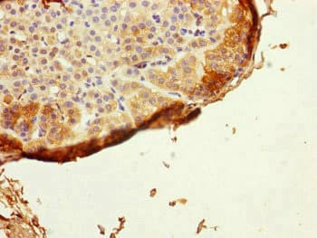 GRPEL1 Antibody