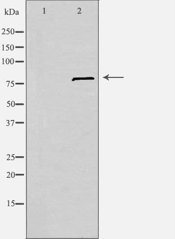 SLC6A15 / SBAT1 Antibody