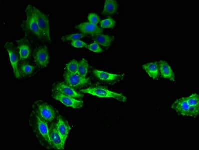 Polyclonal Rabbit anti-Human SLC6A15 / SBAT1 Antibody (IHC, IF)