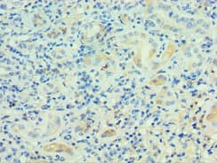 Polyclonal Rabbit anti-Human PSG1 / CD66f Antibody (aa180-419, IHC)