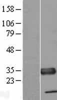 TXNDC1 / TMX1 Protein (Over-Expression Lysate Myc-DDK (Flag))