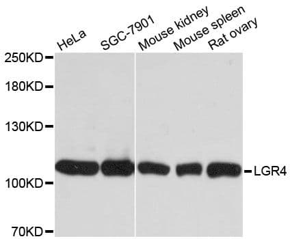 GPR48 / LGR4 Antibody