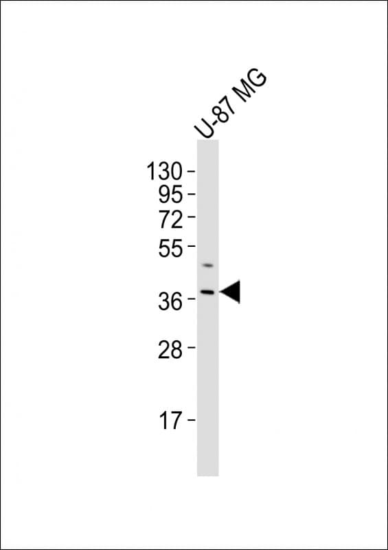Polyclonal Rabbit anti-Human OR4K17 Antibody (aa87-120, WB)
