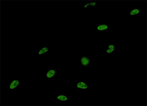 IHC-plus™ SNRPA / U1A Antibody (clone 3F9-1F7)