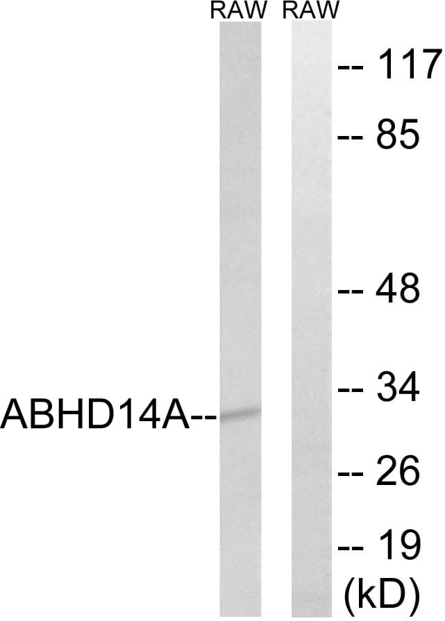 Polyclonal Rabbit anti-Human ABHD14A Antibody (aa201-250, WB)
