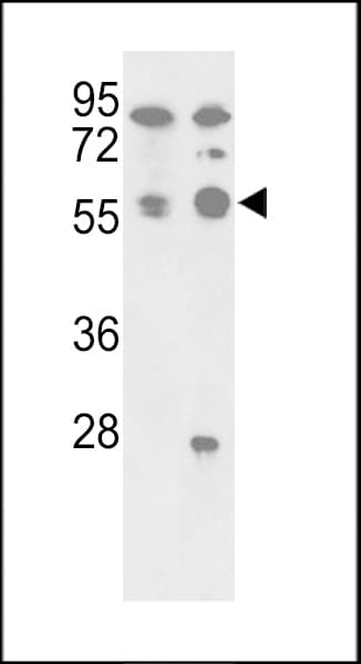 Polyclonal Rabbit anti-Human PPP5C Antibody (aa445-475, IHC, WB)
