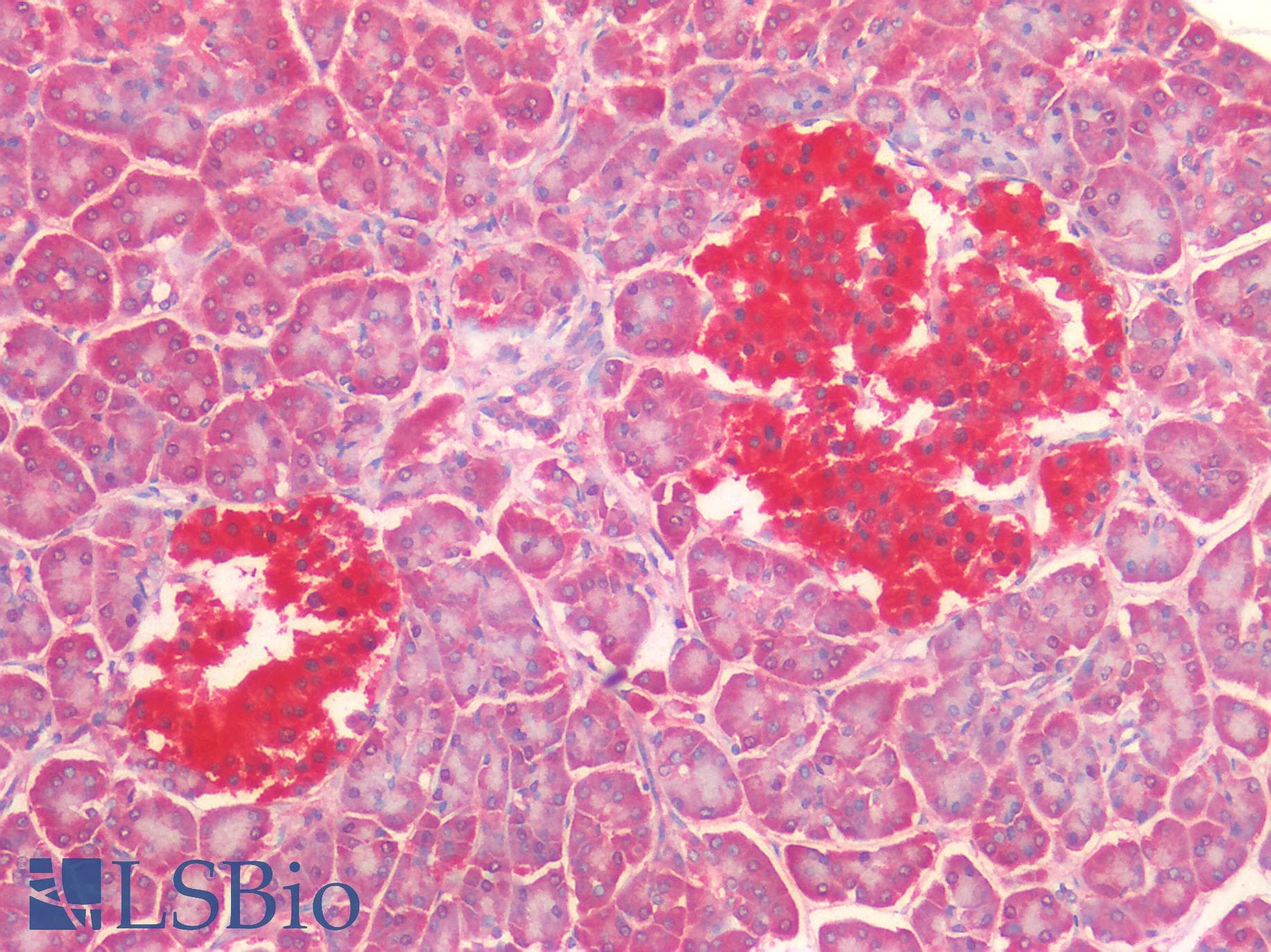 PathPlus™ UCHL1 / PGP9.5 Antibody