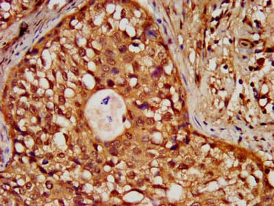 HIST1H3A Antibody