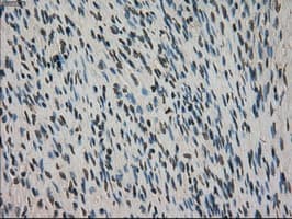 CTAG1B / NY-ESO-1 Antibody (clone OTI3C9)